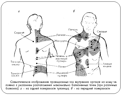 Пиявки на сердце схема